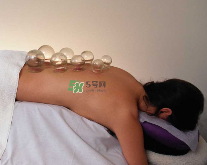 拔火罐一次多長時間？拔火罐一般多長時間？