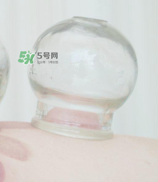 拔火罐一次多長時間？拔火罐一般多長時間？