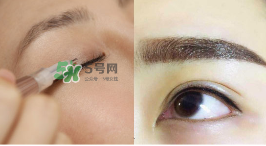 美瞳線有必要做嗎？做美瞳線多少錢(qián)？