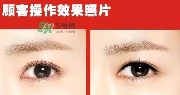 美瞳線有必要做嗎？做美瞳線多少錢(qián)？
