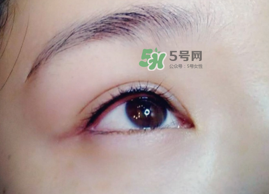 做美瞳線疼嗎？做美瞳線后要注意什么？