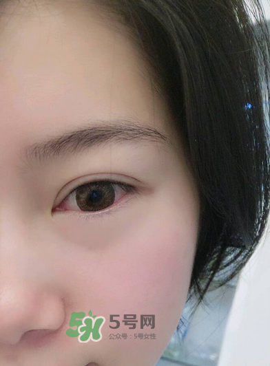 做美瞳線疼嗎？做美瞳線后要注意什么？