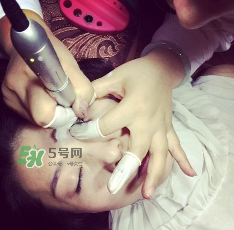 做美瞳線要打麻藥嗎？做美瞳線麻藥怎么敷？