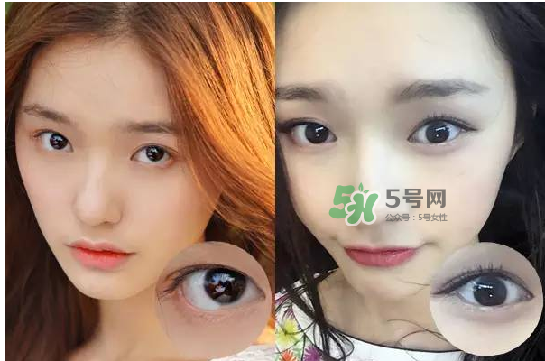 做美瞳線會(huì)不會(huì)掉睫毛？做美瞳線掉睫毛怎么辦？