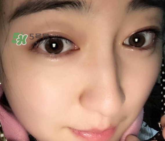 做美瞳線可以喝酒嗎？做美瞳線喝酒有影響嗎？