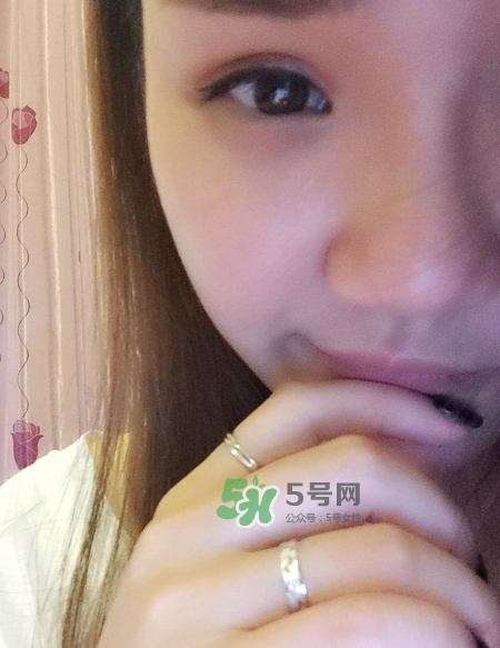做美瞳線可以吃海鮮嗎？做美瞳線能吃海鮮嗎？