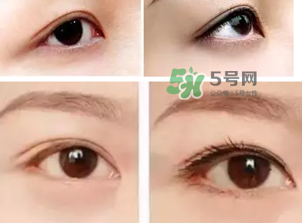 做美瞳線可以吃雞蛋嗎？做美瞳線能吃雞蛋嗎？