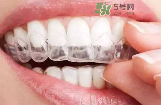 牙齒有縫隙可以補(bǔ)嗎？牙齒縫隙大能補(bǔ)嗎