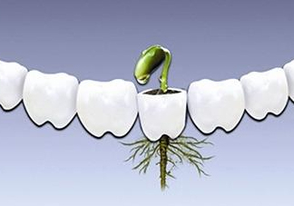 種植牙多少錢一顆？為什么種植牙很貴