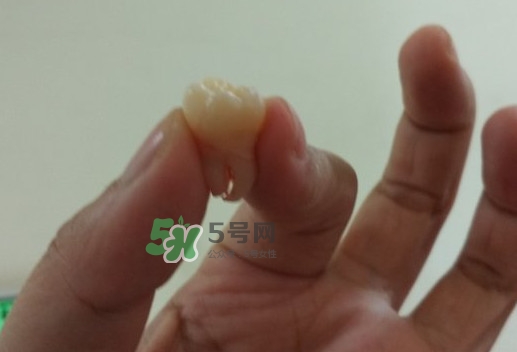 拔智齒痛嗎？智齒拔了多久洞會(huì)好？