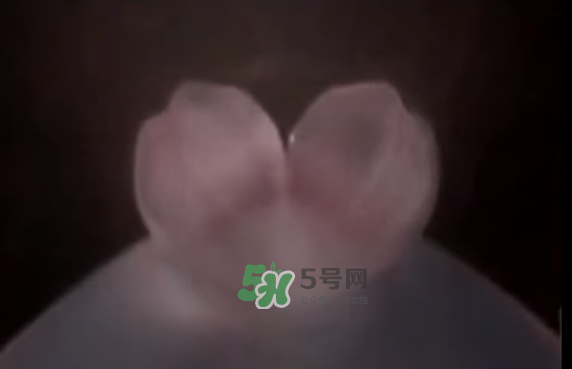 懷孕初期怎么保胎？陰道出血是流產(chǎn)征兆嗎？
