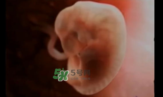 懷孕初期怎么保胎？陰道出血是流產(chǎn)征兆嗎？
