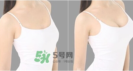 女性乳頭癢是怎么回事？女性乳頭癢要怎么治療？