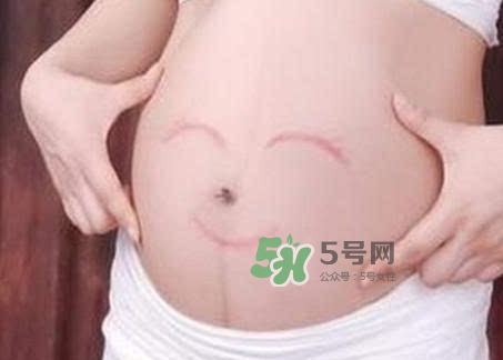 產(chǎn)婦胃脹氣怎么緩解？產(chǎn)婦胃脹氣怎么辦？