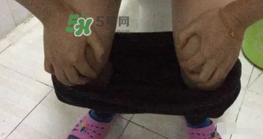 孕期可以蹲著上廁所嗎？孕期上廁所會(huì)壓到寶寶嗎？