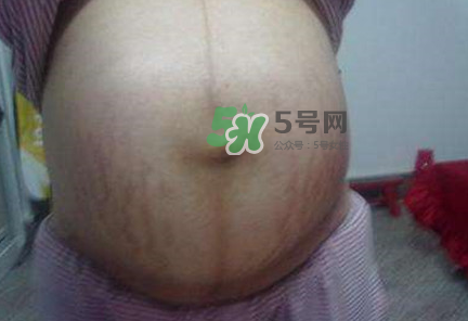 懷女孩肚子上會(huì)長毛嗎？懷女孩肚子特征圖片