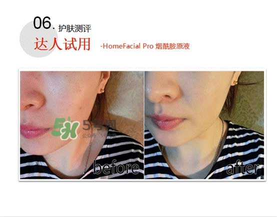 homefacialpro煙酰胺原液怎么樣？hfp煙酰胺原液好用嗎