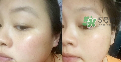 可思美潔面儀好不好用？可思美凈致潔顏聲波潔面儀怎么樣？
