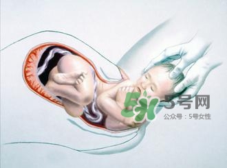 順產(chǎn)和剖腹產(chǎn)哪個好？順產(chǎn)和剖腹產(chǎn)哪個痛？