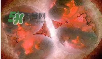 多胞胎是怎么生產(chǎn)的？多胞胎應選擇什么分娩方式