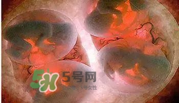 多胞胎順產(chǎn)怎么生？多胞胎剖腹產(chǎn)和單胎剖腹產(chǎn)的區(qū)別