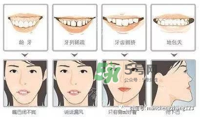 乳牙齲齒要不要補？乳牙齲齒怎么辦？
