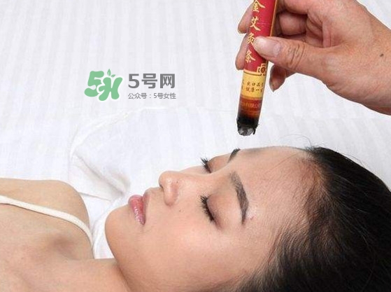 艾灸會不會過敏？艾灸過敏怎么辦