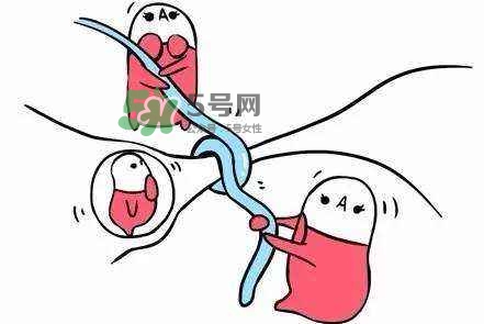 結(jié)扎好還是上環(huán)好？結(jié)扎上環(huán)哪個(gè)危害?。?></p><p style=