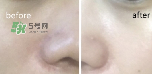 hr綠寶瓶新肌水怎么用？赫蓮娜綠寶瓶新肌水使用方法
