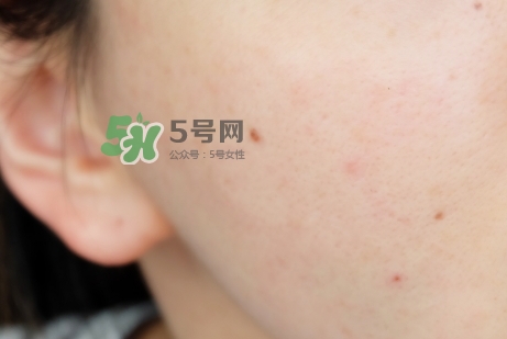 臘梅是什么牌子？臘梅是什么護膚品