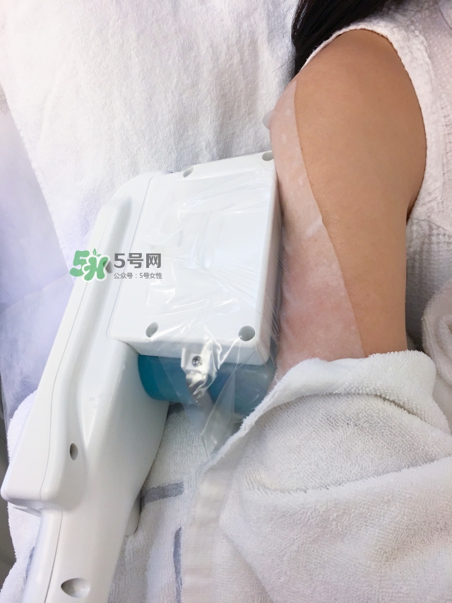 酷塑溶脂效果對(duì)比圖片 酷塑溶脂全過程記錄