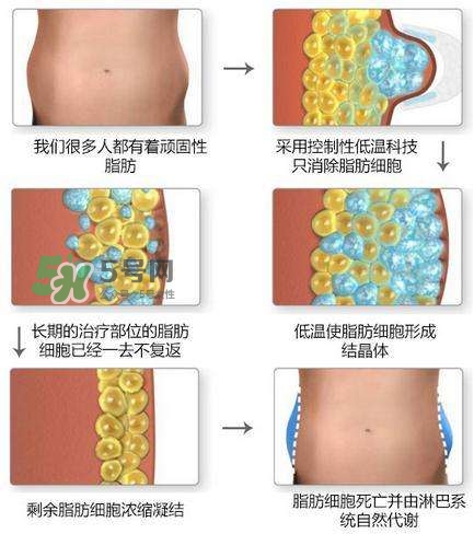 酷塑溶脂效果對(duì)比圖片 酷塑溶脂全過程記錄