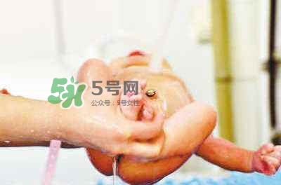 羊水栓塞是醫(yī)療事故嗎？羊水栓塞多發(fā)生于順產(chǎn)還是剖腹產(chǎn)？