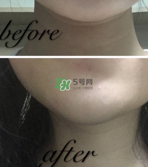 olay小白瓶有哪些版本？olay小白瓶版本區(qū)別