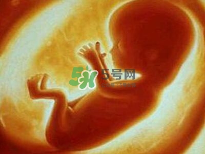 臍帶繞頸是什么原因造成的？臍帶繞頸是多休息還是多運動？