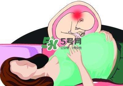 孕婦左側臥睡不著怎么辦？孕期左側睡不舒服怎么辦？