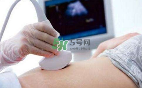 臍帶繞頸是什么原因造成的？臍帶繞頸是多休息還是多運動？