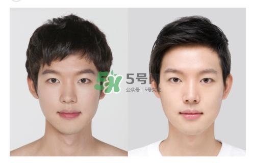 美白針有副作用嗎？美白針有什么副作用？