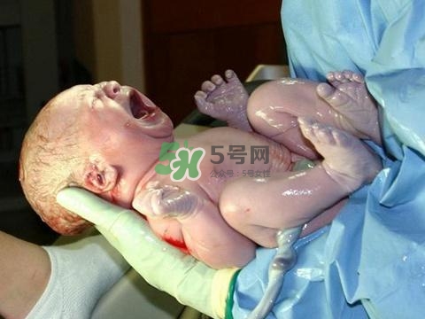 順產(chǎn)有多疼？順產(chǎn)的疼痛可以忍受嗎？