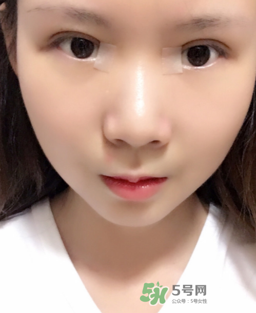 美皮護(hù)去疤效果怎么樣？美皮護(hù)有用嗎？