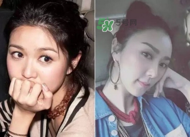 發(fā)際線低怎么調(diào)整？標(biāo)準(zhǔn)的發(fā)際線圖片