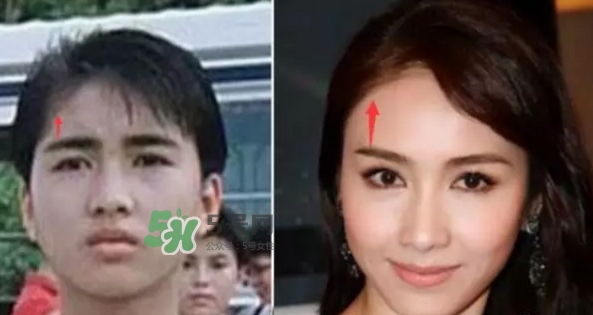 發(fā)際線低怎么調(diào)整？標(biāo)準(zhǔn)的發(fā)際線圖片