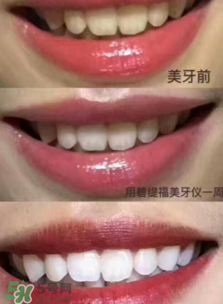 美牙儀能用水洗嗎？美牙儀能用多久？