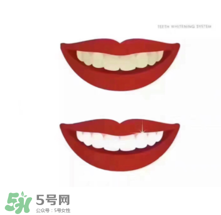 美牙儀能帶上飛機(jī)嗎？美牙儀可以過安檢嗎？