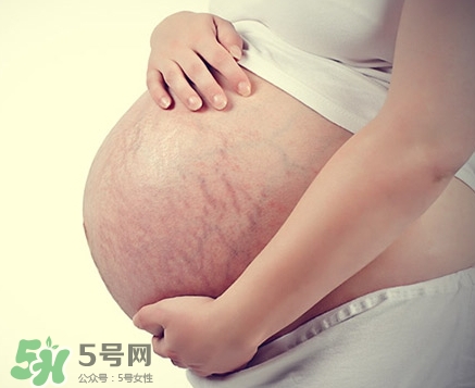 孕婦胸部長(zhǎng)妊娠紋嗎？胸部長(zhǎng)妊娠紋了怎么辦？
