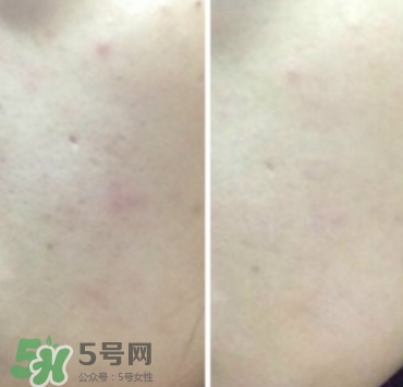 美康粉黛氣墊bb怎么樣？美康粉黛氣墊bb毀容