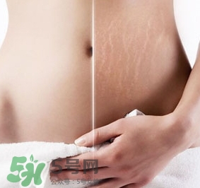 妊娠紋什么時(shí)候變白？妊娠紋產(chǎn)品什么時(shí)候用？