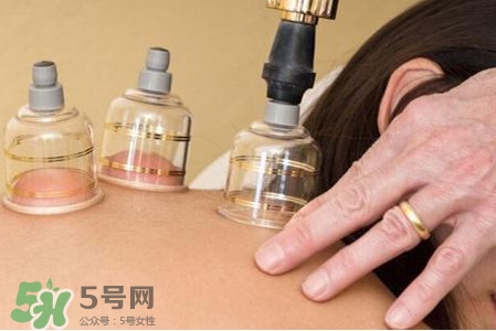 真空拔罐有用嗎？真空拔罐多長時間合適