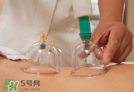 真空拔罐有用嗎？真空拔罐多長時間合適