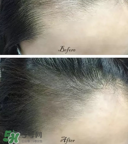 發(fā)際線粉要卸妝嗎_怎么卸？